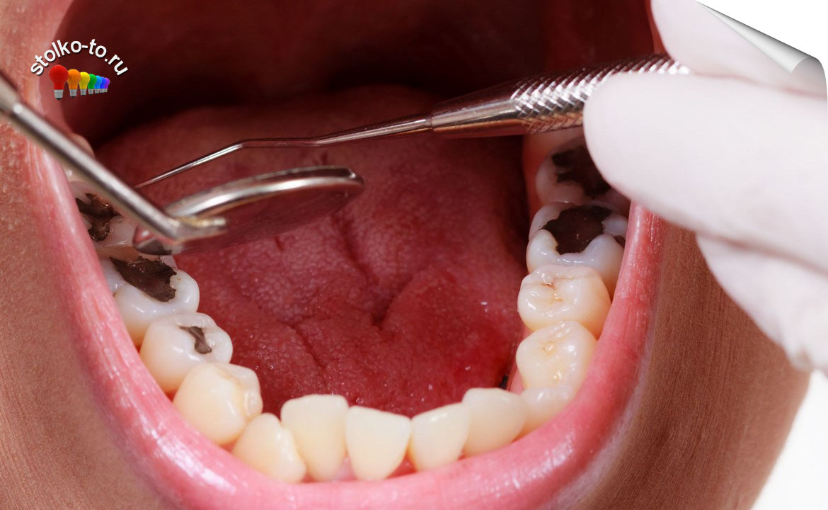 Чем опасны болезни зубов